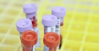 diagnostico-alzheimer-sangre