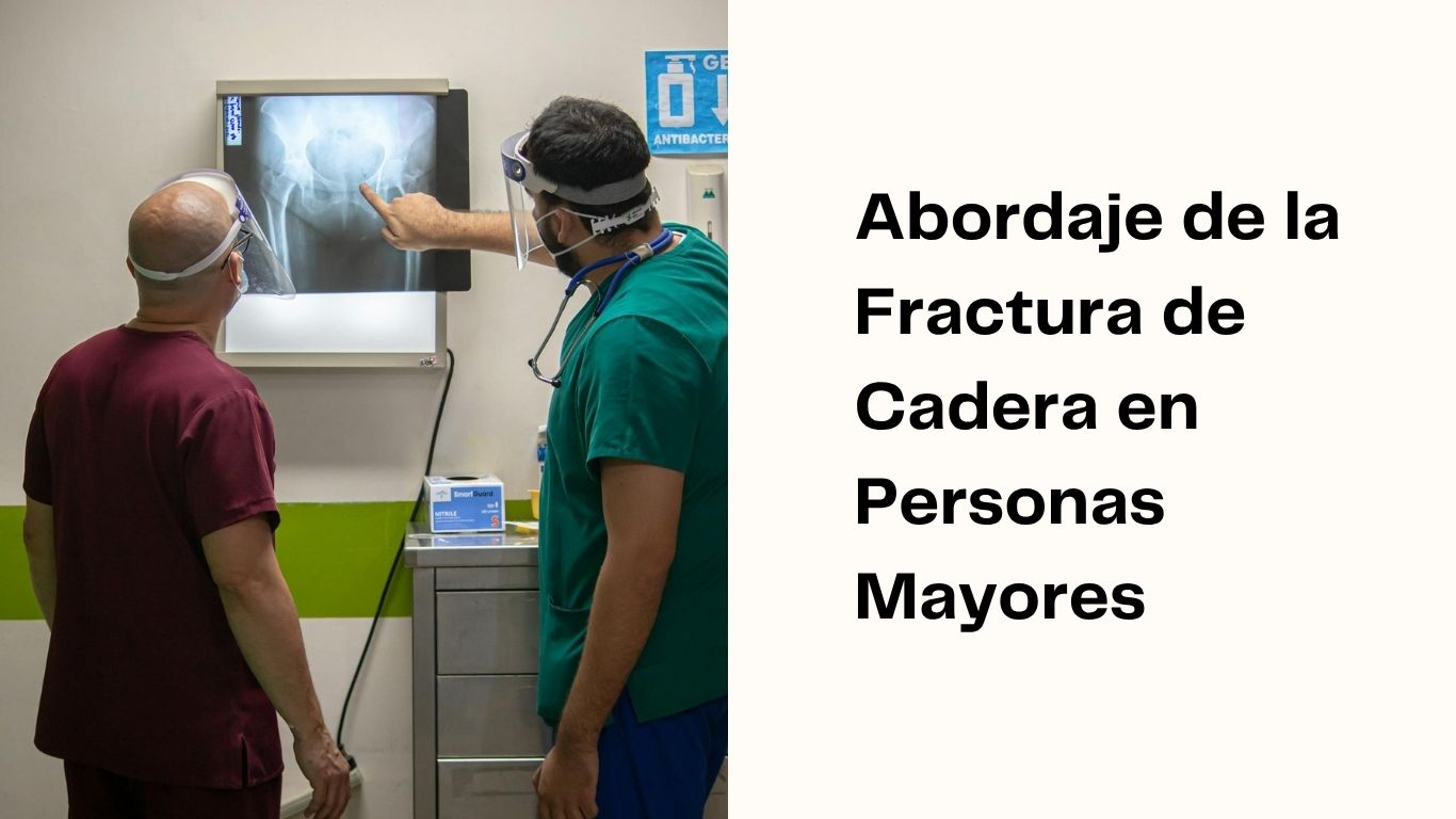 abordaje de la fractura de cadera